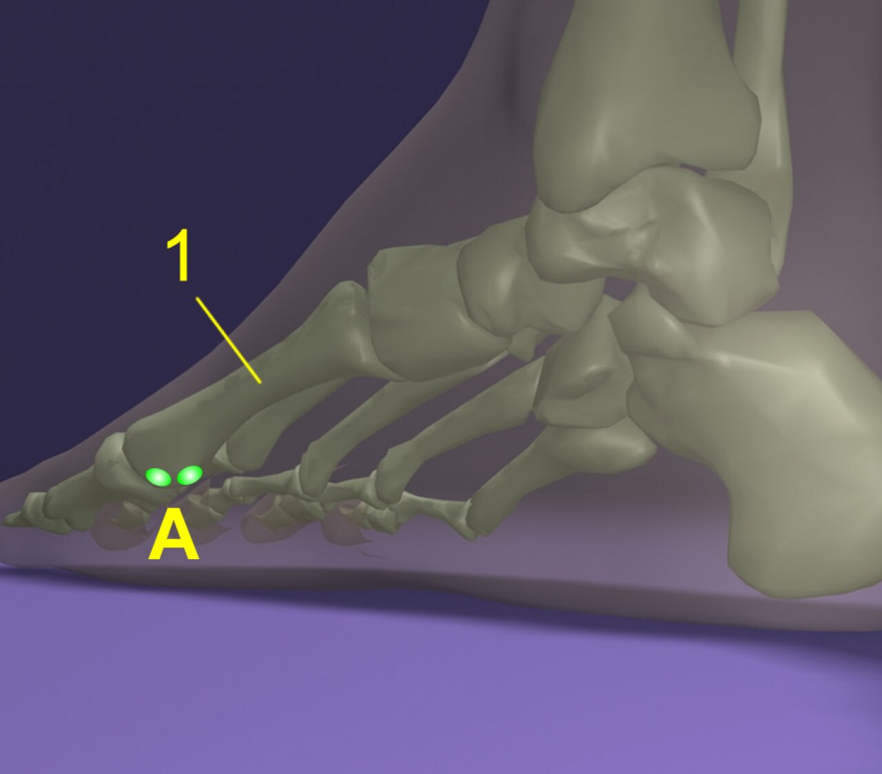 nagylábujj alatti csont fájdalom nyaki osteochondrozis diuretikumok