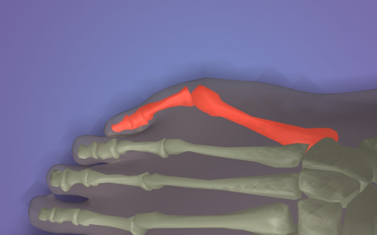 Digitus Quintus Varus